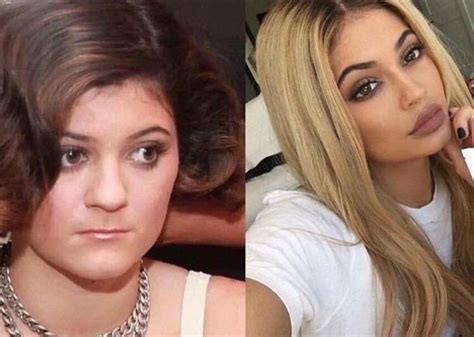 I Want This Puberty Kylie Jenner Plastic Surgery Celebrity Plastic
