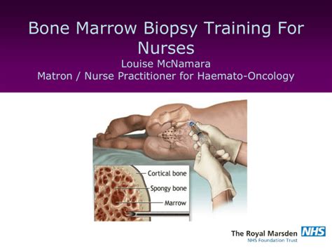 Bone Marrow Biopsy Training For Nurses