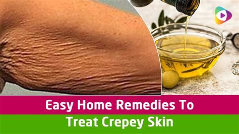 Easy Home Remedies To Treat Crepey Skin Crepey Skin Treatment Youtube