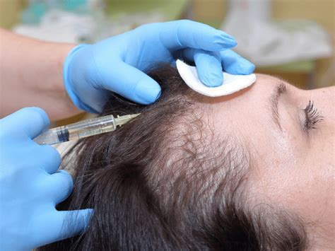 Tailored Hair Loss Treatment Plans Hair Growth Stimulation