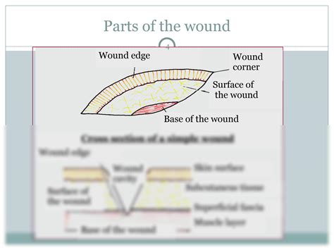 Solution Surgical Wounds Classification And Types Of Wound Closure