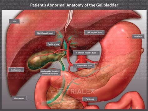Patient S Abnormal Anatomy Of The Gallbladder Illustration Tria