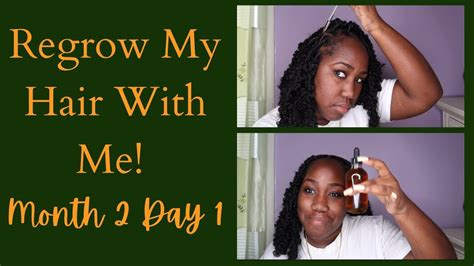 Growing My Hair Back Month 2 Day 1 I Really Surprised Myself Youtube