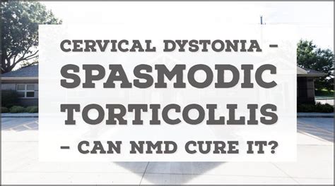 Cervical Dystonia Spasmodic Torticollis Can Nmd Cure It