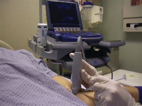 Ultrasound Guided Arterial Puncture Respiratory Care
