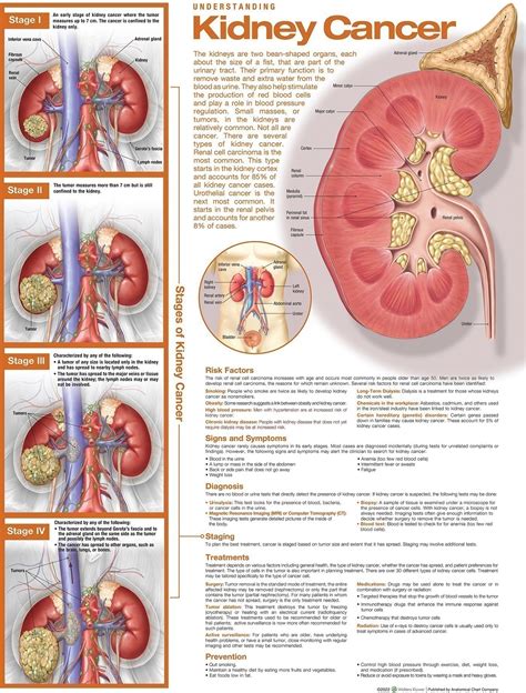 Anatomy Charts And Posters Understanding Kidney Cancer Anatomical Chart