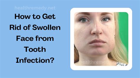 How To Get Rid Of Swollen Face From Tooth Infection