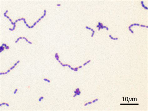 Bacteria Wikidoc