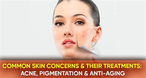 Common Skin Concerns And Their Treatments Acne Pigmentation And Anti
