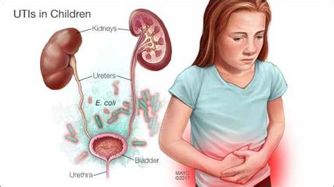 Young Children Under The Age Of 5 Are At The Risk Of Urinary Tract