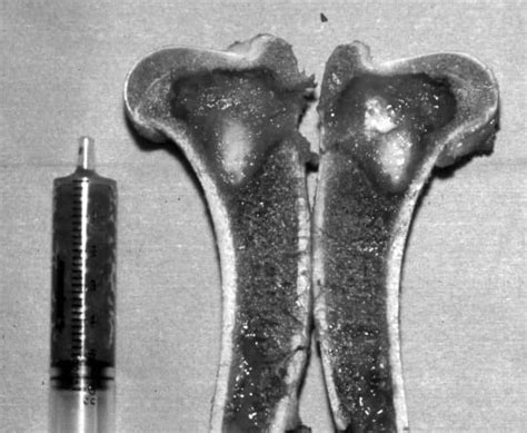 Bone Grafts And Implants Ivis