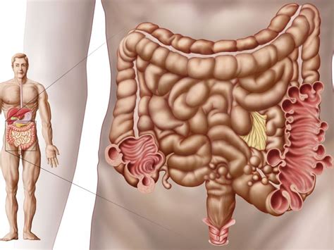 Sakit pinggang sebelah kiri bisa disebabkan banyak hal, sehingga penanganannya juga harus ditangani dengan tepat. Penyebab Sakit Perut Sebelah Kiri | TradisionalSehat.com