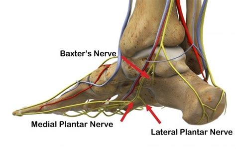 5 Questions Guide Relief From Plantar Fasciitis Pain