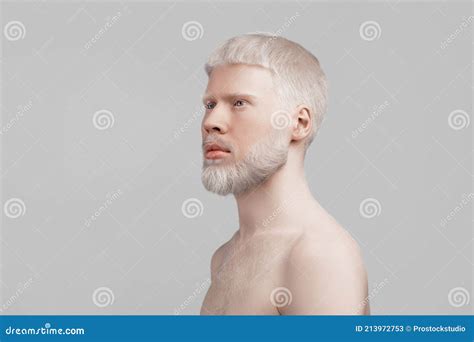 Albinism Thin Albino Man Posing On Light Grey Studio Background