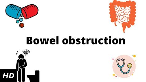 Bowel Obstruction Causes Signs And Symptoms Diagnosis And Treatment