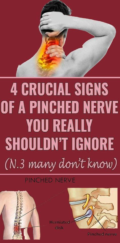 4 Crucial Signs Of A Pinched Nerve You Really Shouldt Ignore Health