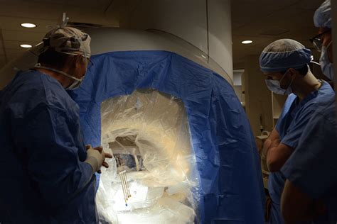 Litt Device Makes Epilepsy Surgery More Precise Less Invasive Inside