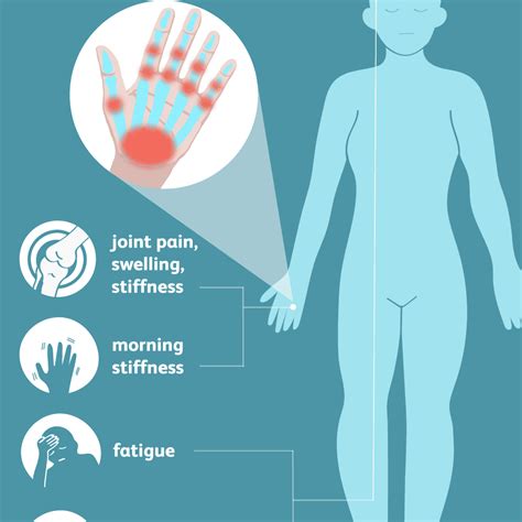 Rheumatoid Arthritis Signs Symptoms And Complications