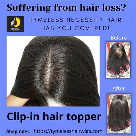 All About Diffuse Alopecia Areata Tymeless Hair And Wigs