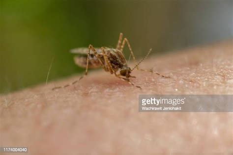 Mosquito Bite Photos And Premium High Res Pictures Getty Images