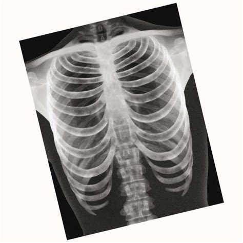 röntgenbilder mensch backwinkel de