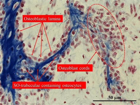 Histological Section Of An Intramembranous Ossification Center Showing Download Scientific