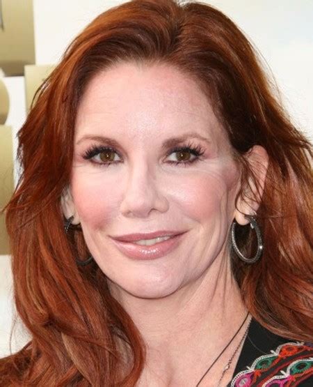 The Melissa Gilbert Plastic Surgery How Did It Go Plastic Surgery