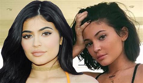 Kylie Jenner Removes All Lip Fillers After Years Of Criticism Extra Ie