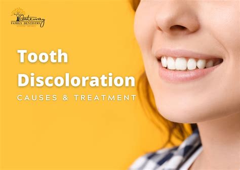 tooth discoloration causes prevention and solutions gateway dentistry tn