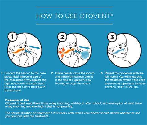 How Otovent Works Using Otovent Balloon For Glue Ear · Otovent