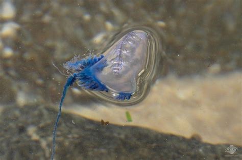 Bluebottles Stings And All You Need To Know Seaunseen