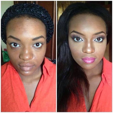 Skin Bleaching Before And After Pictures Skinsa