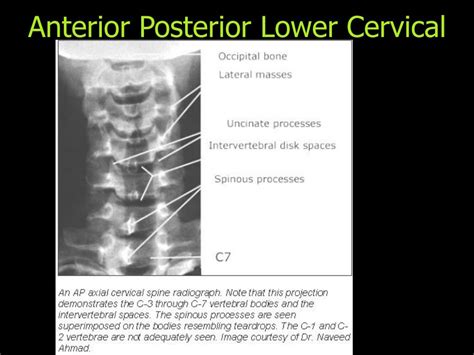 Ppt Normal X Ray Anatomy Powerpoint Presentation Free Download Id