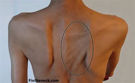 What To Do For A Pulled Muscle In Back Body Pain Tips