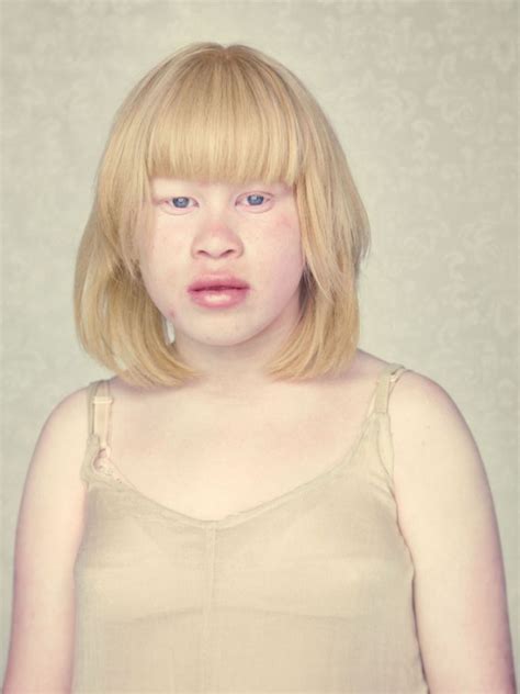 Stunning Photo Series Gives Albinos A Closer Look Albino Model