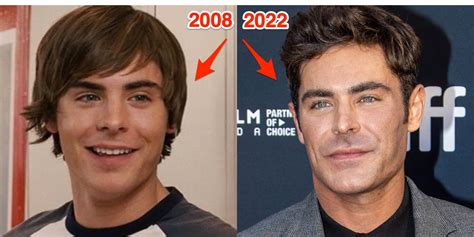 zac efron almost died in accident that shattered his jaw