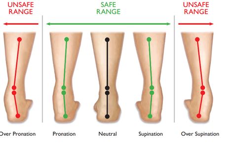 Foot Posture And Back Pain