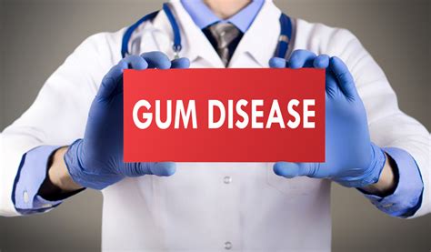 Essential Tips On How To Keep Your Gums Healthy And Strong