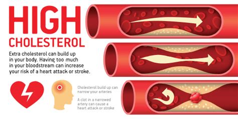 Managing Your Cholesterol Heart Disease Risk Factors Nz The Heart