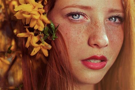 A Woman With Freckled Hair And Blue Eyes Is Looking At The Camera While Surrounded By Yellow Flowers