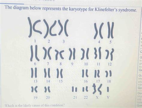 Solved The Diagram Below Represents The Karyotype For Klinefelters Syndrome S T A