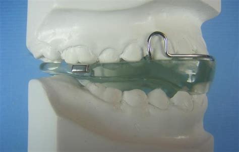 Basic Activator Accutech Orthodontic Labs