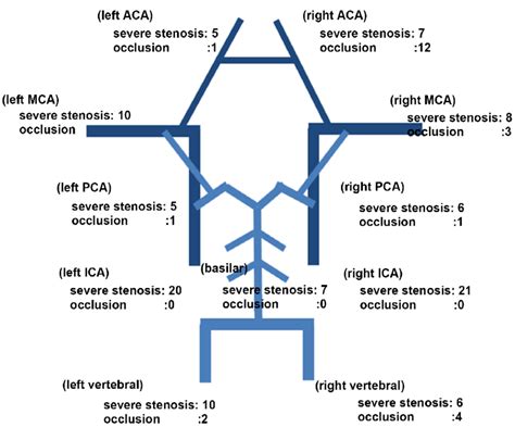 Distribution Of Intracranial Arterial Stenosis 70 And Occlusion