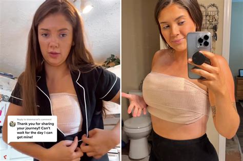 My 34e Breasts Caused My Spine To Curve — Now Im Getting Surgery