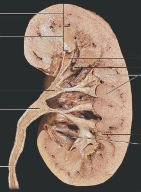 Aff Lab Kidney Diagram Quizlet