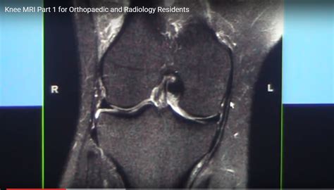 Learning Mri Of The Knee —