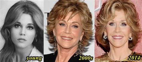 Jane Fonda Ceek Enhancement - Plastic Surgery Feed