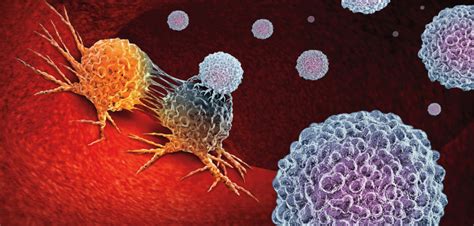 Customized Immunotherapy Shows Promise For Lung Cancer Cancer Health