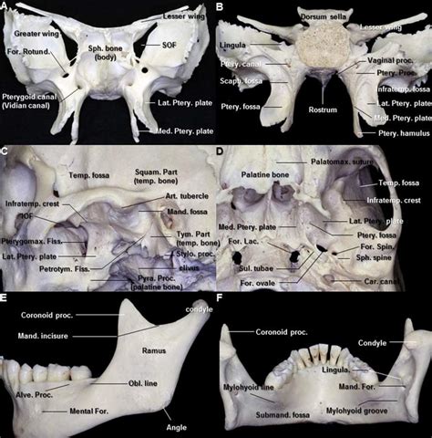 Osseous Relationships Of The Infratemporal Fossa Sphenoid Bone And