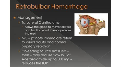 In Light Of Managing Retrobulbar Hemorrhage Obn